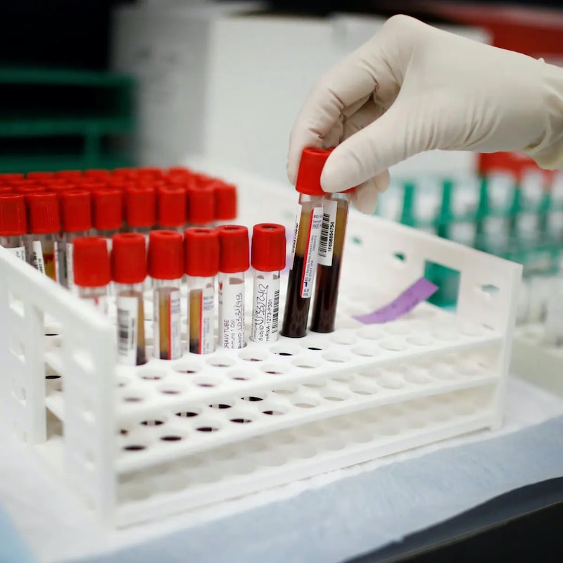 اهدای پلاسما